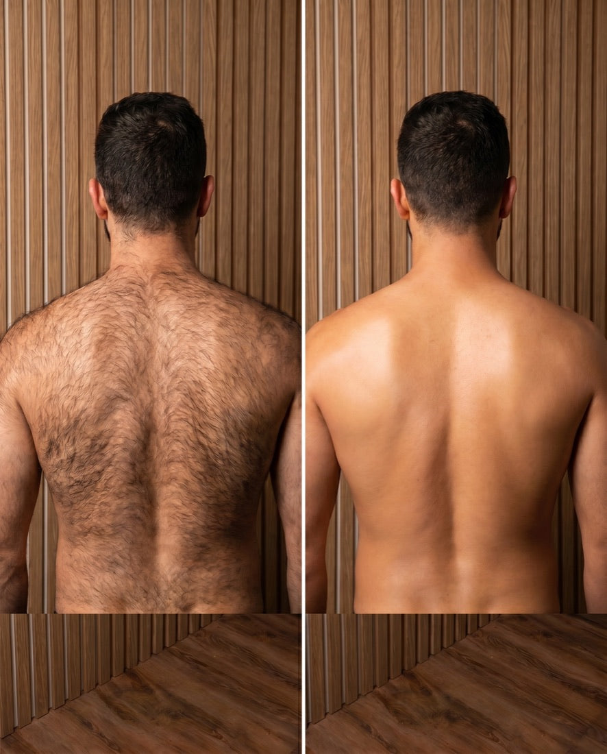 Back