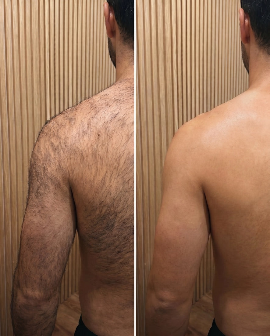 Shoulders